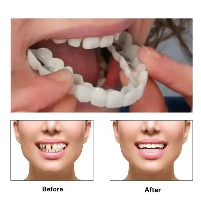 1Pair Adjustable Dental Veneers Unisex Teeth Veneer for Men and Women
