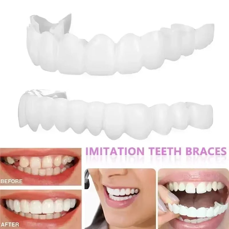 1Pair Adjustable Dental Veneers Unisex Teeth Veneer for Men and Women