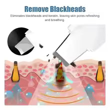 Deep Vibrate Skin Scrubber Facial Cleaner Shovel Spatula Not Ultrasonic Face ScrubberPeeling Blackhead Remover Facial